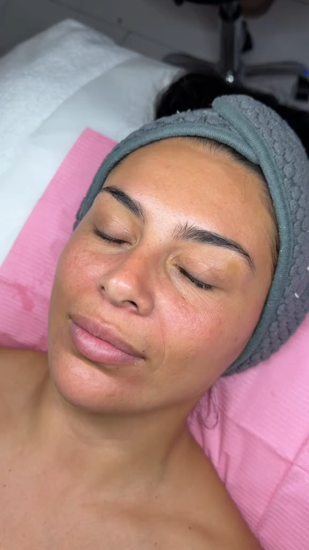 Vista previa de resultados progresivos